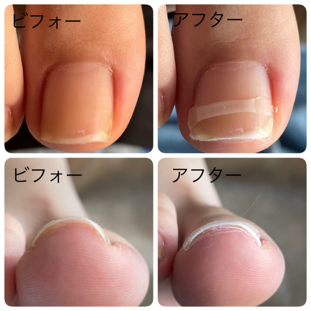 ポドストライプ