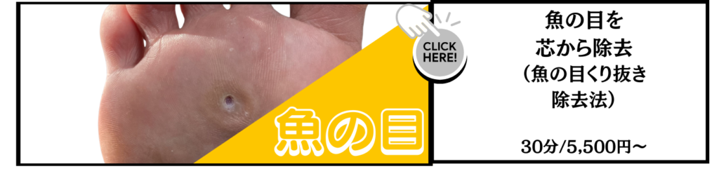 一度で魚の目を芯から除去