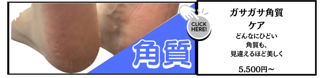 ガサガサ角質・カチコチ角質　どんな角質もツルツルになります　平均30分〜６０分　セルフケアの方法もご指導します